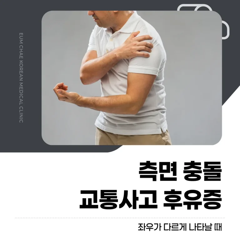 측면 충돌 교통사고 후유증, 좌우가 다르게 나타날 때
