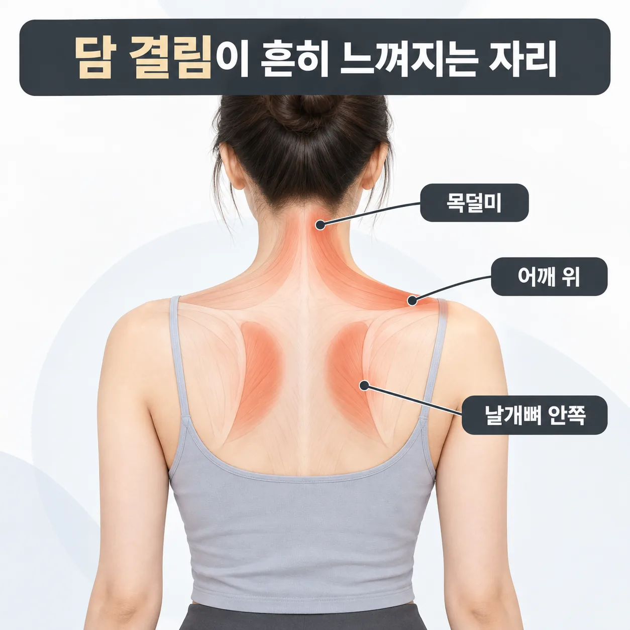 목덜미에서 날개뼈 안쪽까지 담 결림이 느껴지는 자리를 표시한 개념도
