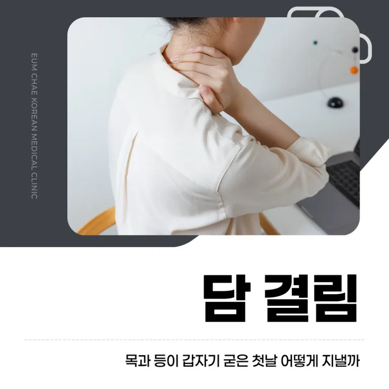 담 결림, 목과 등이 갑자기 굳은 첫날 어떻게 지낼까