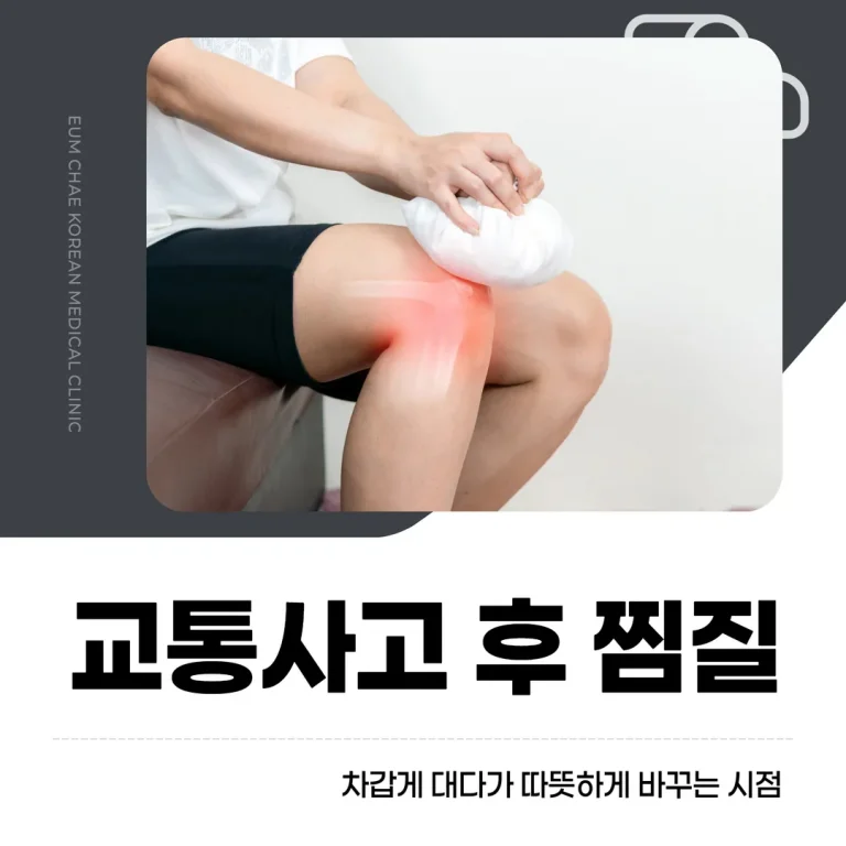 교통사고 후 찜질, 차갑게 대다가 따뜻하게 바꾸는 시점