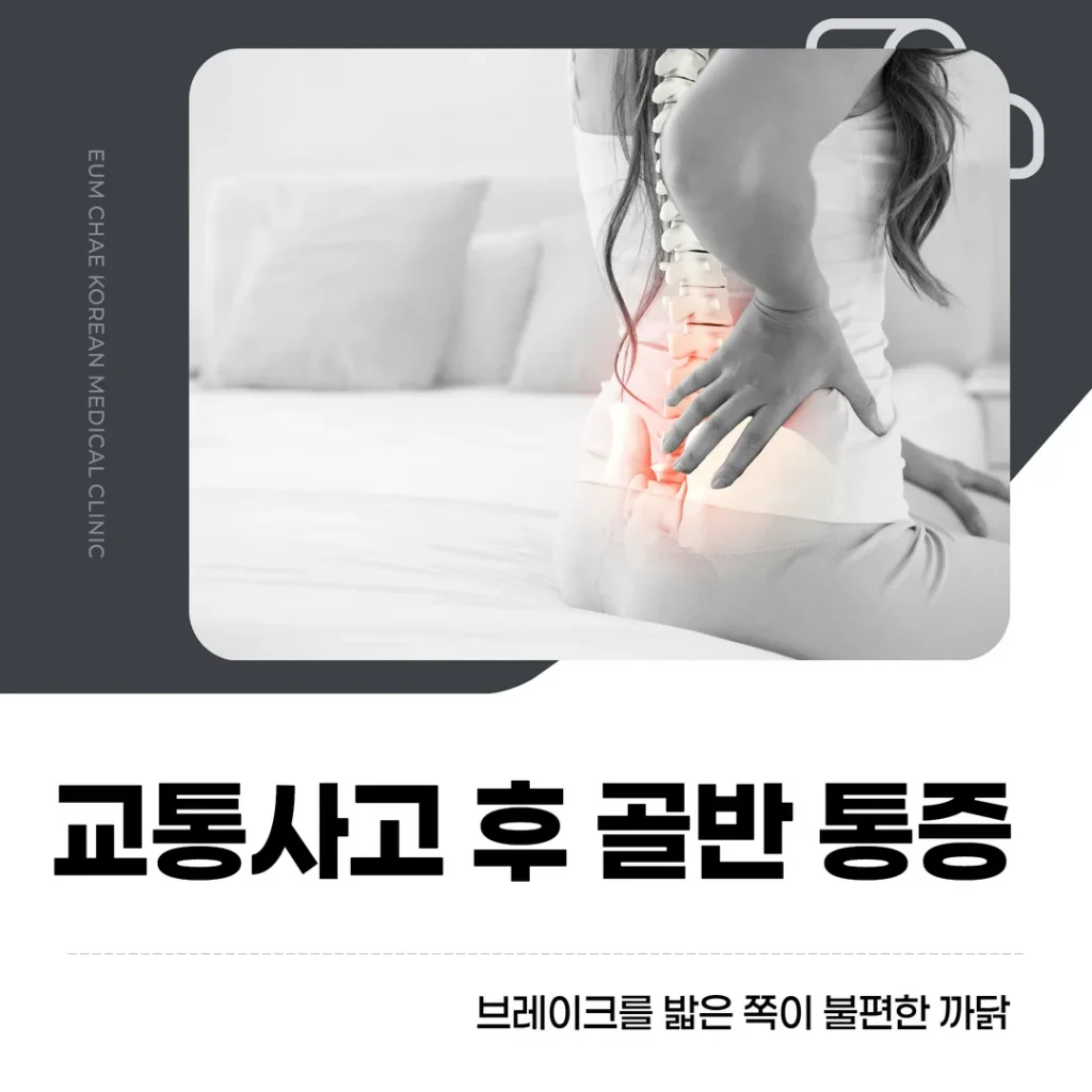 교통사고 후 골반 통증, 브레이크를 밟은 쪽이 불편한 까닭