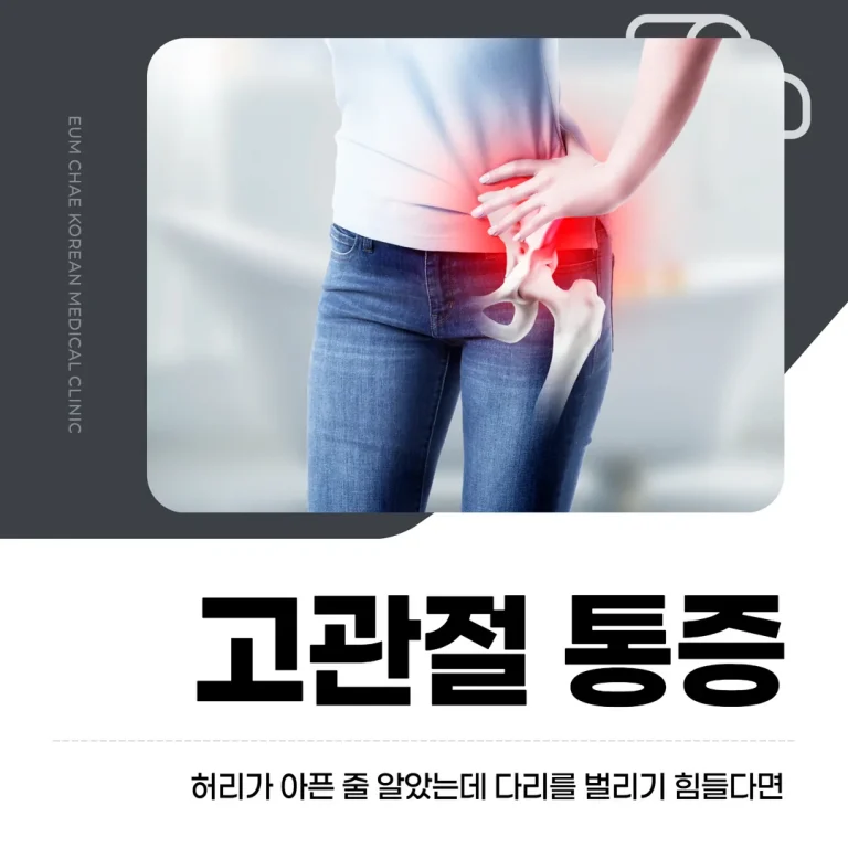 고관절 통증, 허리가 아픈 줄 알았는데 다리를 벌리기 힘들다면